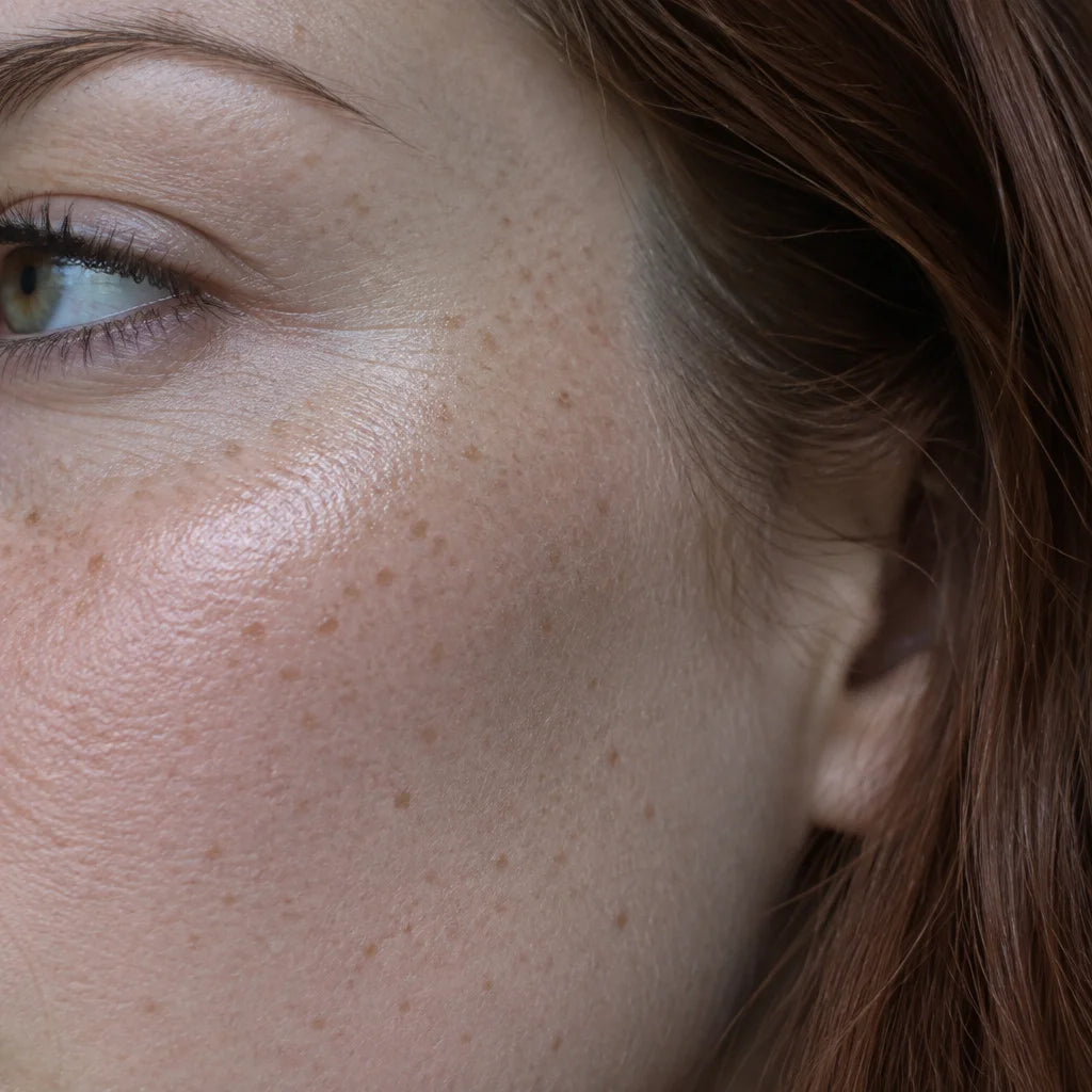 A close macro photograph of the cheek and temple of a 31-year-old German woman with fair cool-toned